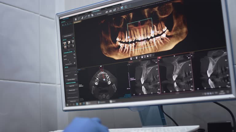 TMJ/TMD Treatment in Rome, NY